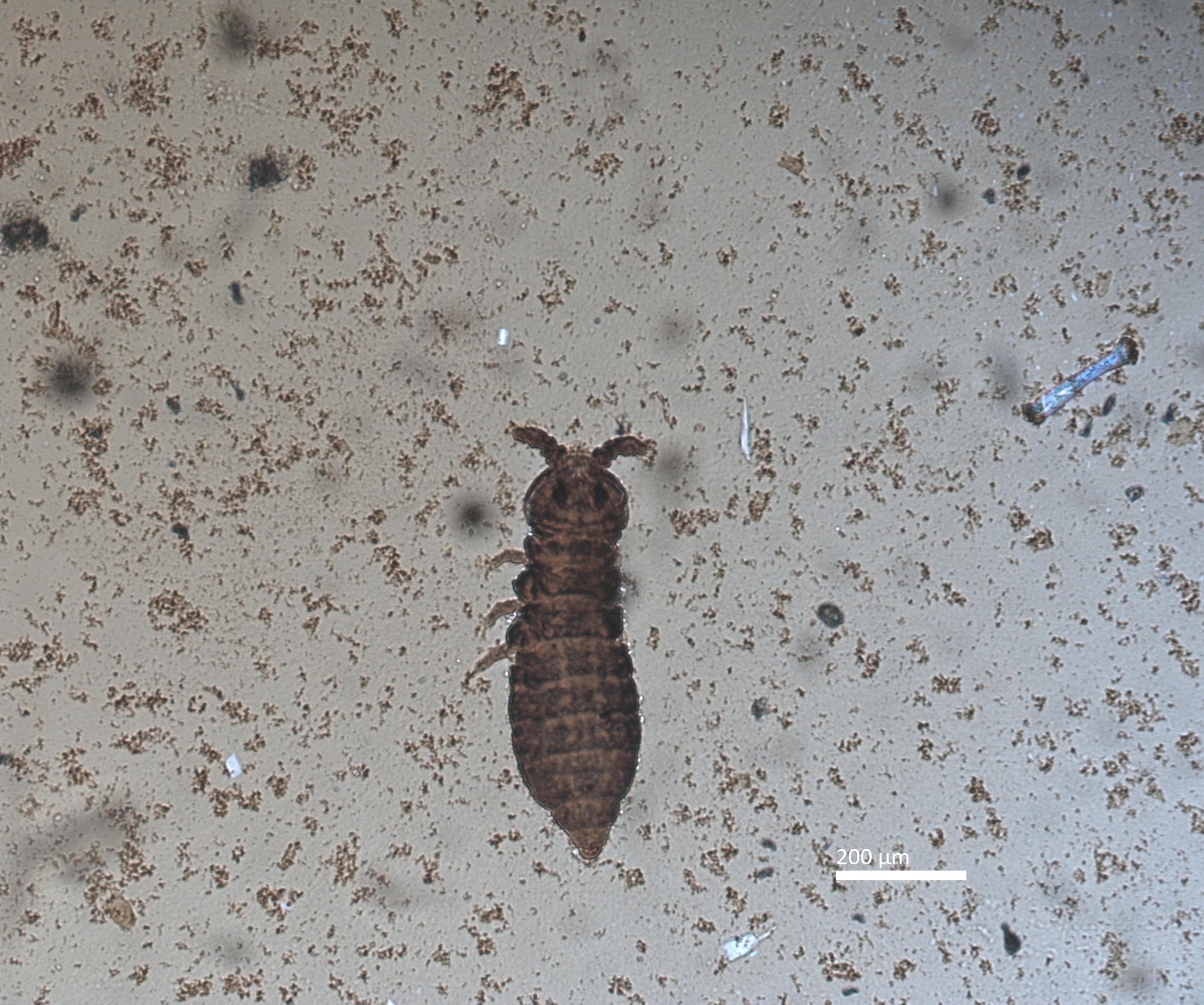 Slide preparation of Xenylla yucatana, housed in the ICCDRS collection (ICCDRS 27095). Photo: Marc Barreda, CDF, 2024.